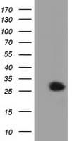 GSTT2 Antibody (clone OTI7A12)