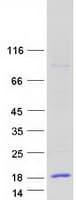 Human CCL15 / MIP5 Protein (Recombinant Myc-DDK (Flag))