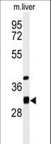 ECHDC1 Antibody (aa254-283)