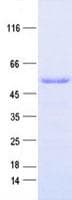 Human NSUN5 Protein (Recombinant DDK,C-terminus)