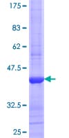 Human FDPS Protein (Recombinant GST, N-terminus)