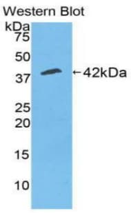 CKM / Creatine Kinase MM Antibody (aa11-367)
