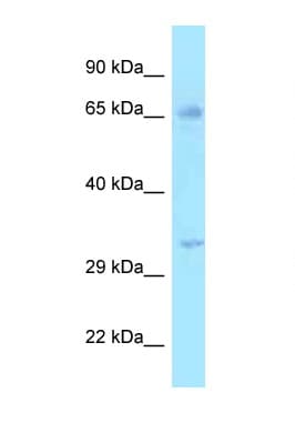Polyclonal Rabbit anti-Human HSD17B3 Antibody (aa51-100, WB)