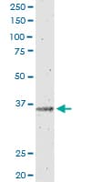 IL12B / IL12 p40 Antibody (clone 2H6)