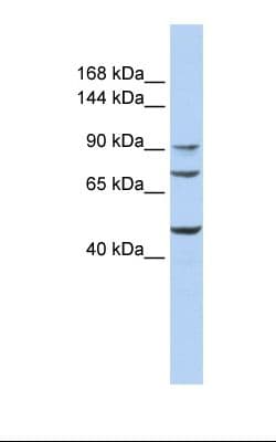 GALNT5 Antibody (aa701-750, HRP)