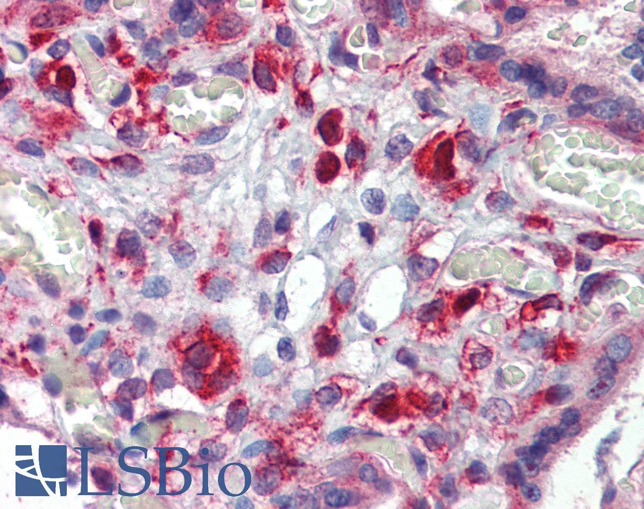 IHC-plus™ AAK1 Antibody
