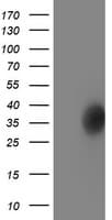 LACTB2 Antibody (clone OTI3A5)