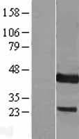 DUSP9 Protein (Over-Expression Lysate Myc-DDK (Flag))