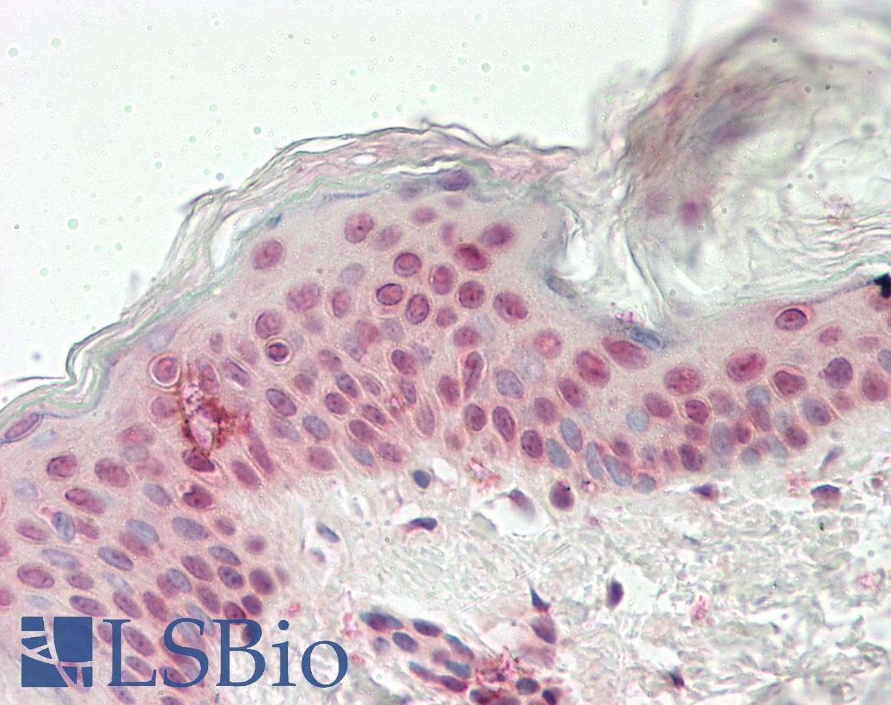IHC-plus™ KMT2D / MLL2 Antibody (clone 2E1)