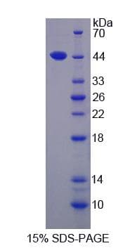 Mouse ACAT1 Protein (Recombinant His-S)