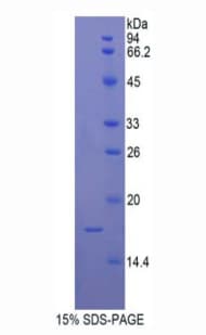 Human UCP2 Protein (Recombinant His)