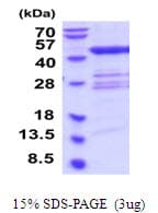 Human QTRT1 Protein (Recombinant His)
