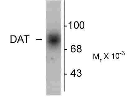 Polyclonal Rabbit anti-Human SLC6A3 / Dopamine Transporter Antibody (C-Terminus, WB)