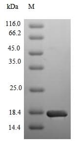 Human SMARCA4 / BRG1 Protein (Recombinant 6His, N-terminus)