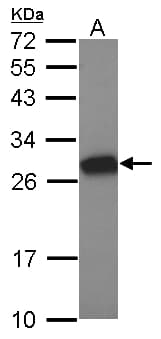 MTL5 / TESMIN Antibody