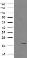 Monoclonal Mouse anti-Human CTAG1B / NY-ESO-1 Antibody (clone OTI5H4, IHC, IF, WB)