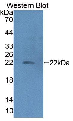 HP / Haptoglobin Antibody (aa177-342, Cy3)
