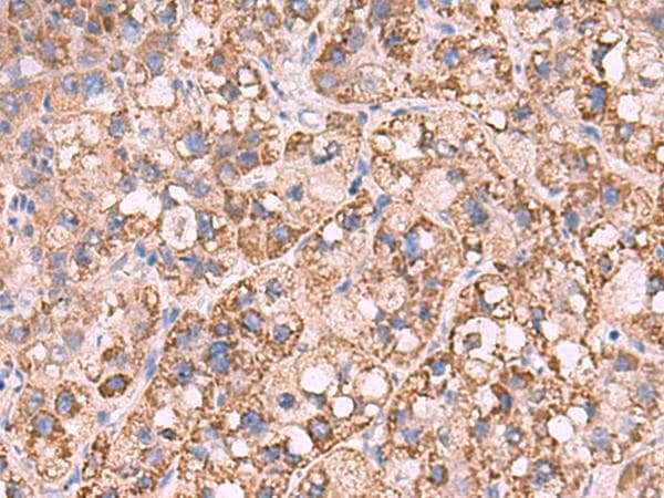 KCNN1 Antibody