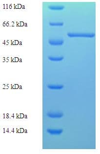 Human ATP6AP2 / Renin Receptor Protein (Recombinant His, N-Terminal)