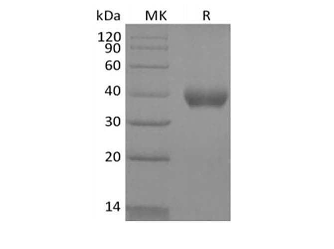 Human IL2RB / CD122 Protein (Recombinant AVI-6His, C-terminus)