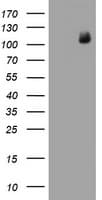 PR / Progesterone Receptor Antibody (clone OTI11G9)