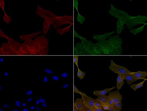 Monoclonal Mouse anti-Human KRT19 / CK19 / Cytokeratin 19 Antibody (clone UMAB3, aa240-390, IHC, IF, WB)