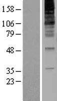 RNF139 / TRC8 Protein (Over-Expression Lysate Myc-DDK (Flag))