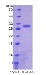Rat SIRT1 / Sirtuin 1 Protein (Recombinant His)