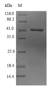 Human KDM3B / JMJD1B Protein (Recombinant 10His-SUMO, N-terminus + Myc, C-terminus)