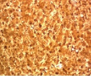ARG1 / Arginase 1 Antibody (C-Terminus, clone T1ARG-1)