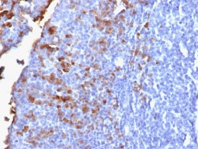 Recombinant Monoclonal Rabbit anti-Human IgG Heavy Chain Antibody (clone IG1707R, IHC)