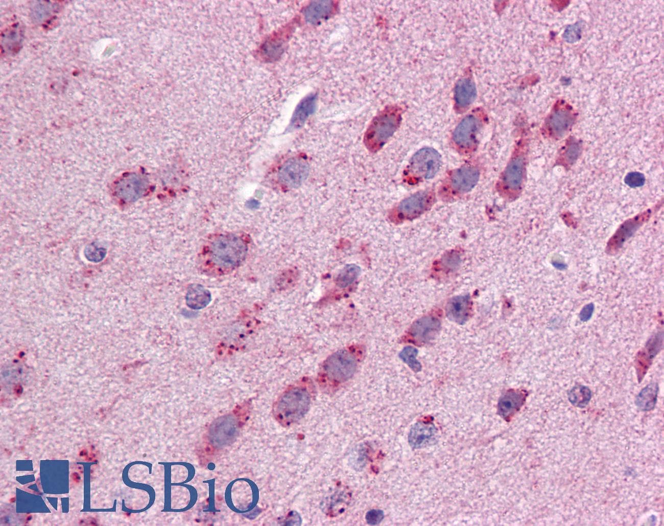 IHC-plus™ GJB3 / CX31 / Connexin 31 Antibody (C-Terminus)