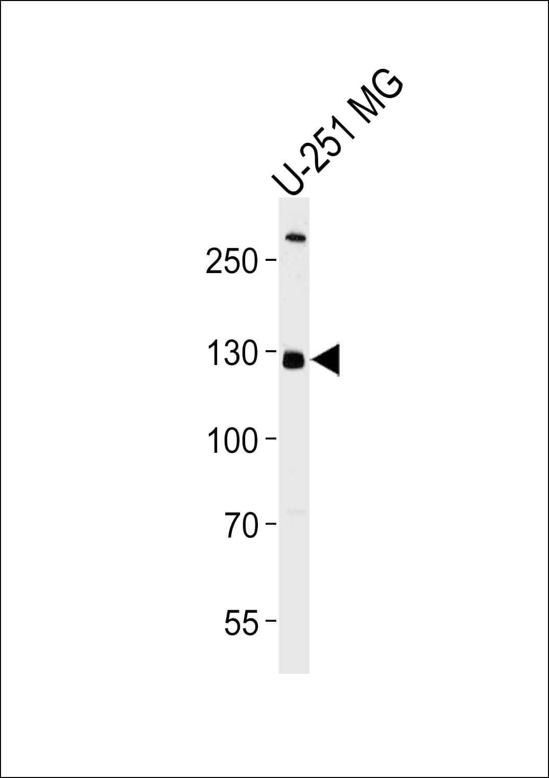PIK3C3 / VPS34 Antibody (aa770-801)