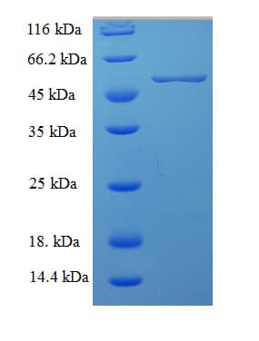 Human MFGE8 /Lactadherin Protein (Recombinant His-SUMO)