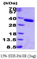 Human Esterase D / ESD Protein (Recombinant His)