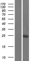 C16orf74 Protein (Over-Expression Lysate Myc-DDK (Flag))