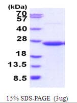 Human CD58 Protein (Recombinant His)