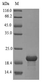 Rat SORT1 / Sortilin Protein (Recombinant 6His, N-terminus)