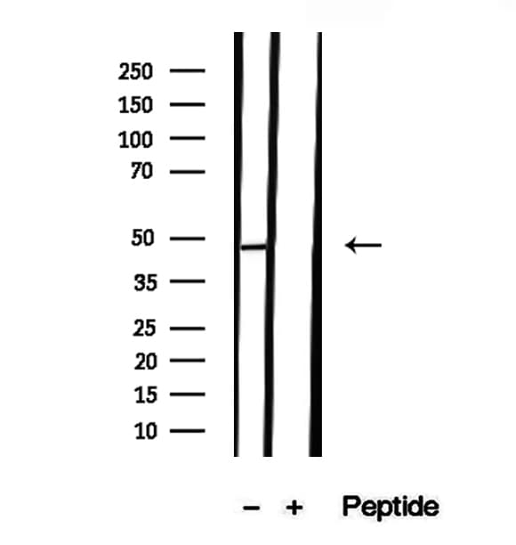 TIMM44 / TIM44 Antibody