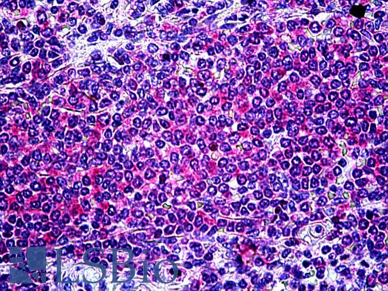 IHC-plus™ ITK / EMT Antibody (aa596-607)