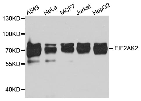 Polyclonal Rabbit anti-Human EIF2AK2 / PKR Antibody (IHC, WB)