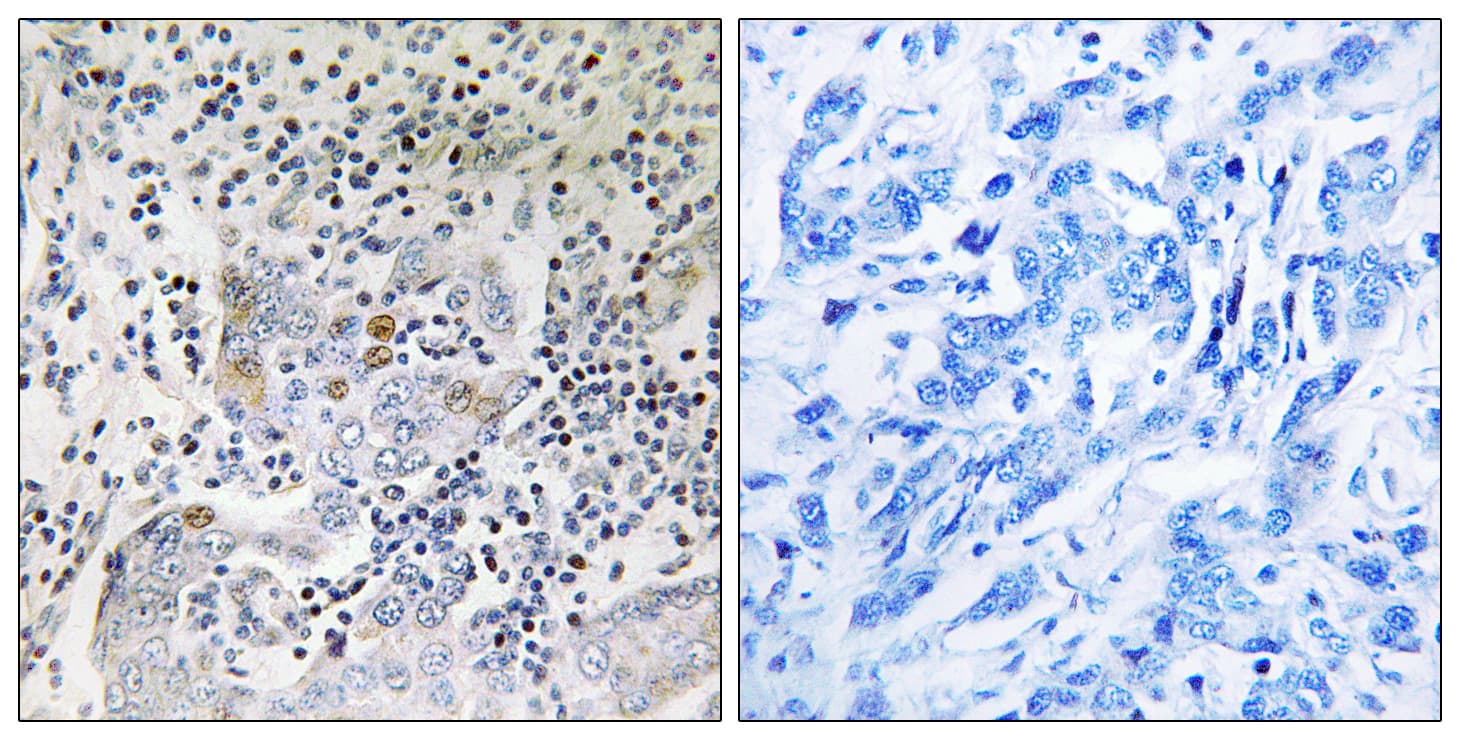 PA26 / SESN1 Antibody (aa271-320)