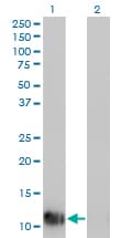 FABP1 / L-FABP Antibody (clone 4G5)