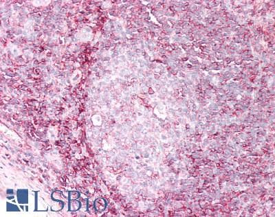 IHC-plus™ Polyclonal Goat anti-Human HLA-B Antibody (IHC, WB)
