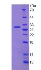 Human ABCC2 / MRP2 Protein (Recombinant His)