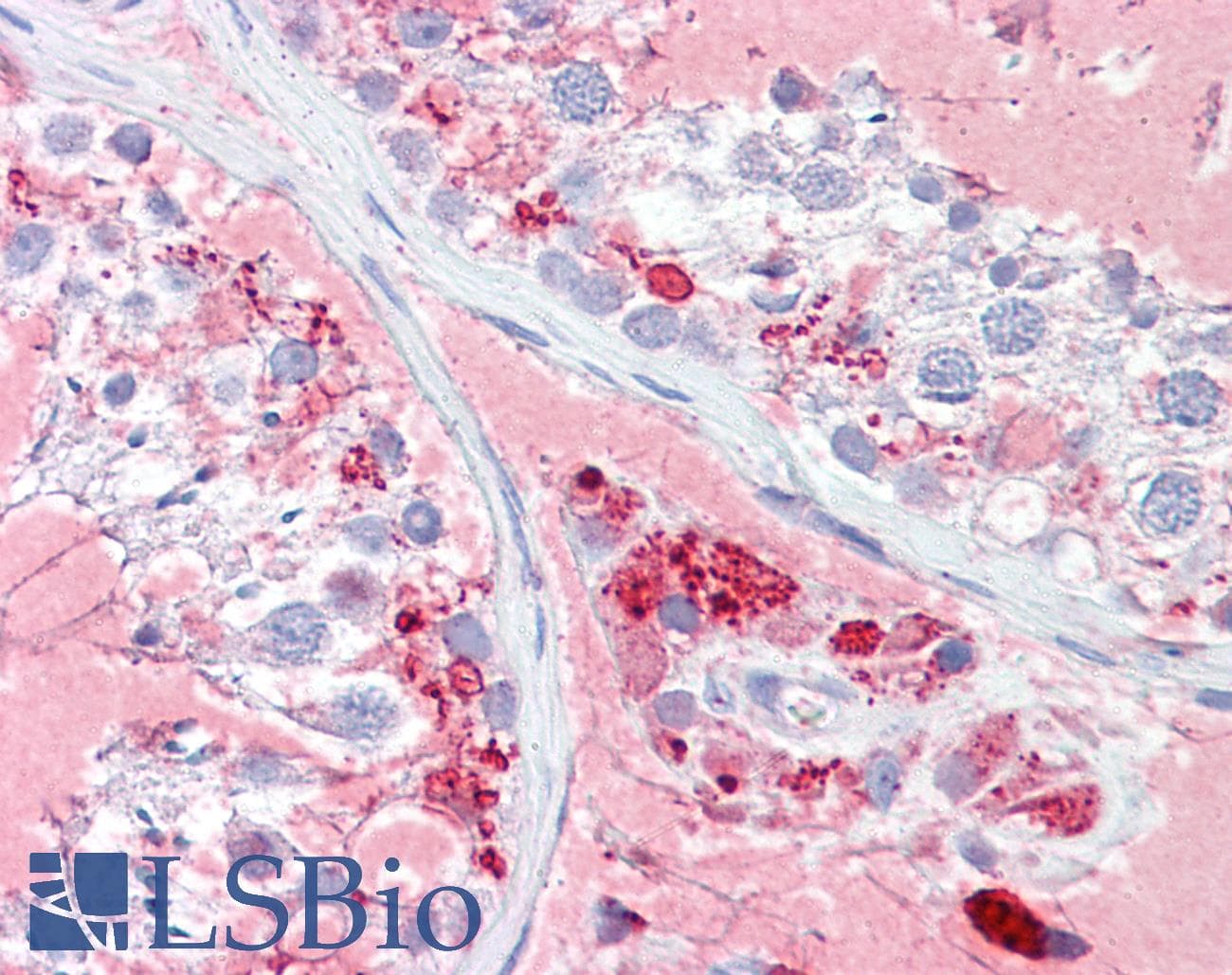 IHC-plus™ Polyclonal Rabbit anti-Human CHEK2 / CHK2 Antibody (aa35-84, IHC, WB)