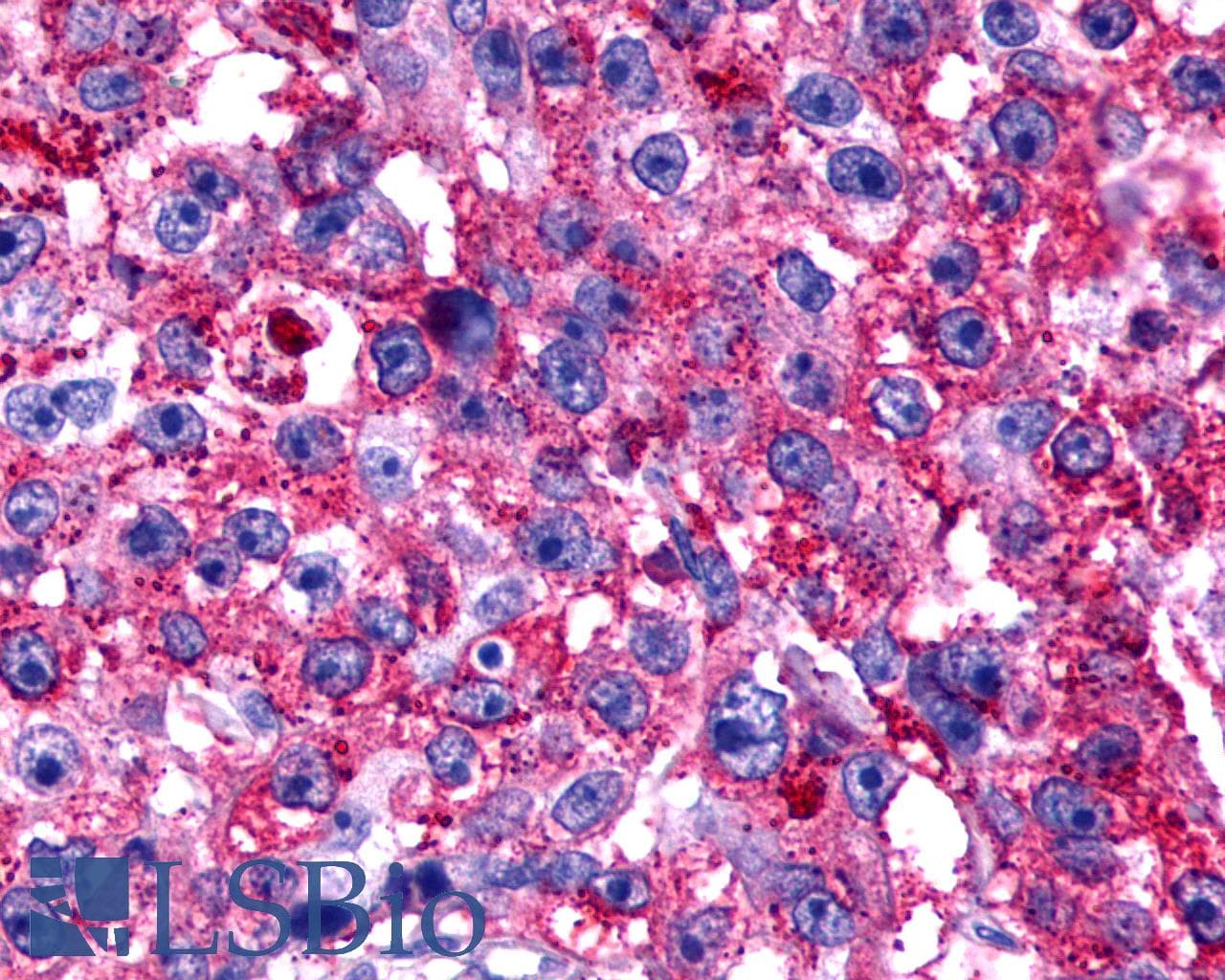 PathPlus™ Polyclonal Rabbit anti-Human TPRA1 / GPR175 Antibody (N-Terminus, IHC)