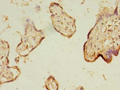 Polyclonal Rabbit anti-Human NARS2 Antibody (IHC)