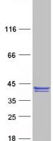 Human CLVS1 Protein (Recombinant Myc-DDK (Flag))
