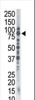Polyclonal Rabbit anti-Human SMURF1 Antibody (aa711-740, IHC, WB)
